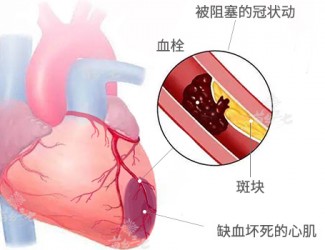 心臟病該怎么辦，且看臨床治療醫(yī)案一則
